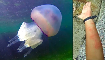 АльфаСтрахование: Самые дорогие случаи страховых выплат за границей в 2023 году