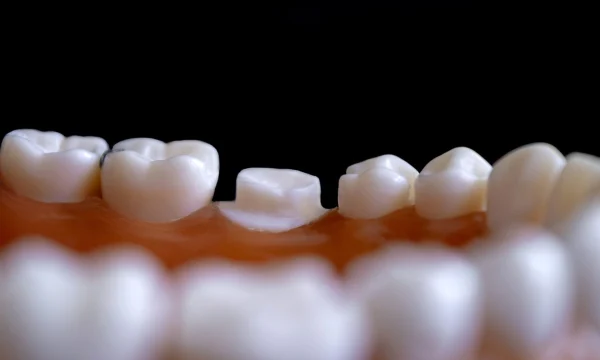 Японский стартап Toregem Biopharma готовится к прорывным клиническим испытаниям «средства для восстановления зубов»